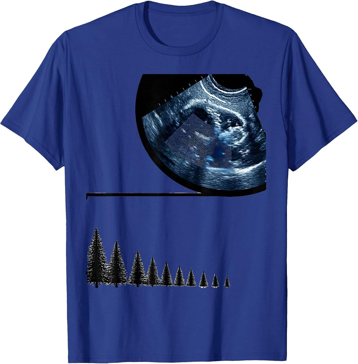 Ultrasound Probe Head Christmas Sonographer Humor T-Shirt - Royal Blue