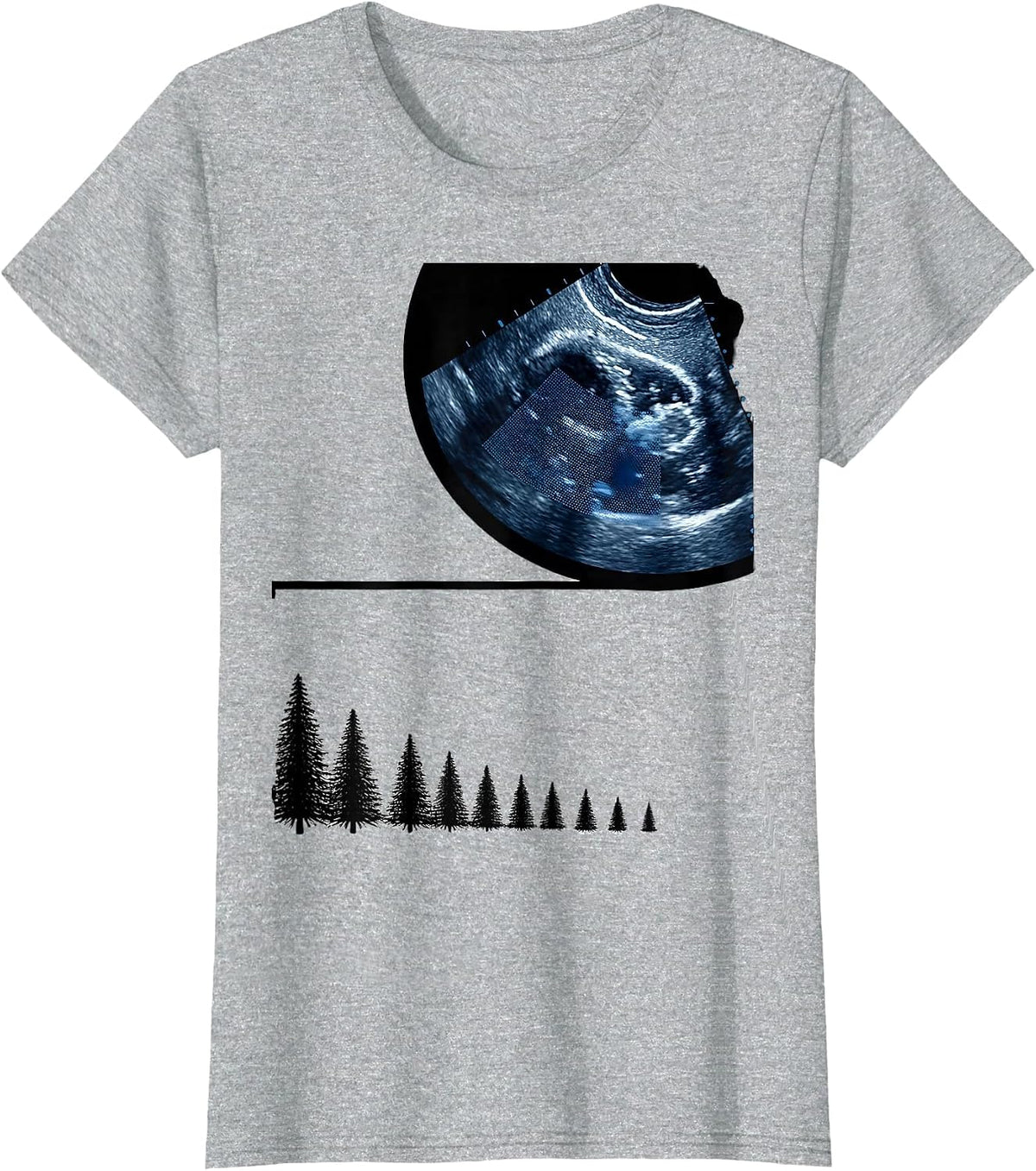 Ultrasound Probe Head Christmas Sonographer Humor T-Shirt - Heather Grey